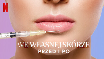 We własnej skórze: Przed i po (2020)